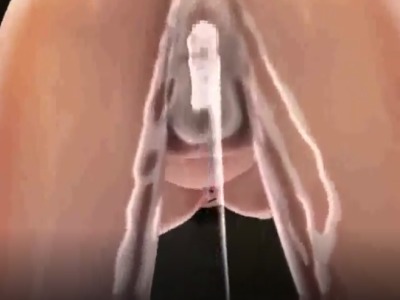 Thumbnail of post image 076